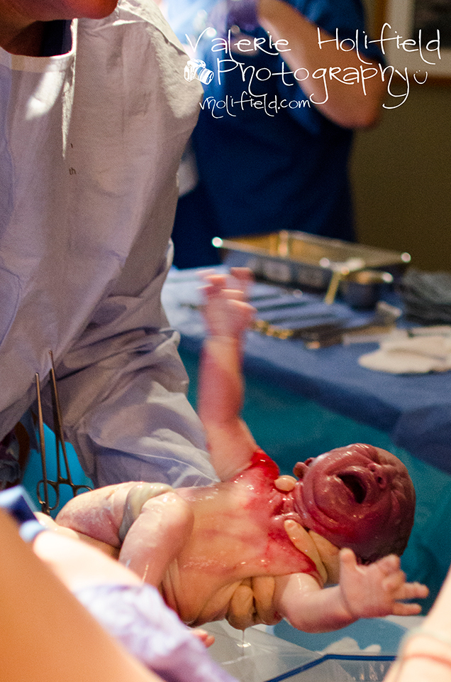 St. Louis Labor and Delivery Photographer | Aven, A Story of New Life, Part II - Birth 